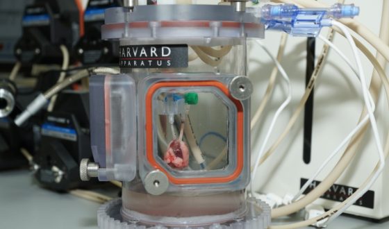 Unique bioreactors installed and launched at the Center for Regenerative Medicine of Kuban State Medical University