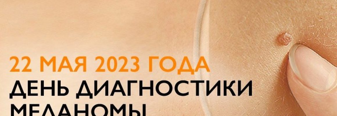 22 мая 2023 года ДЕНЬ ДИАГНОСТИКИ МЕЛАНОМЫ